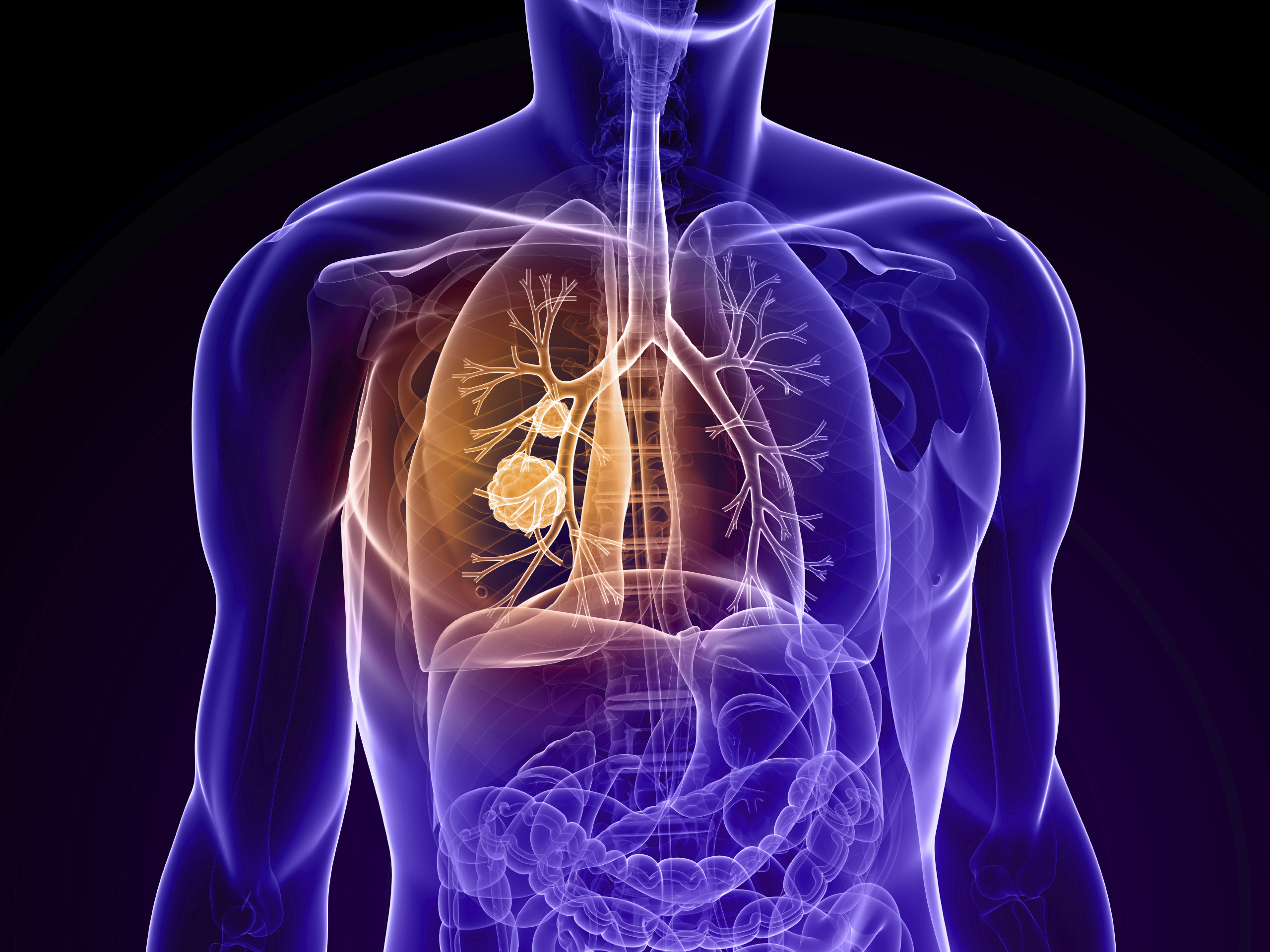 Top 10 Therapy Interventions For COPD Functional Pathways Blog